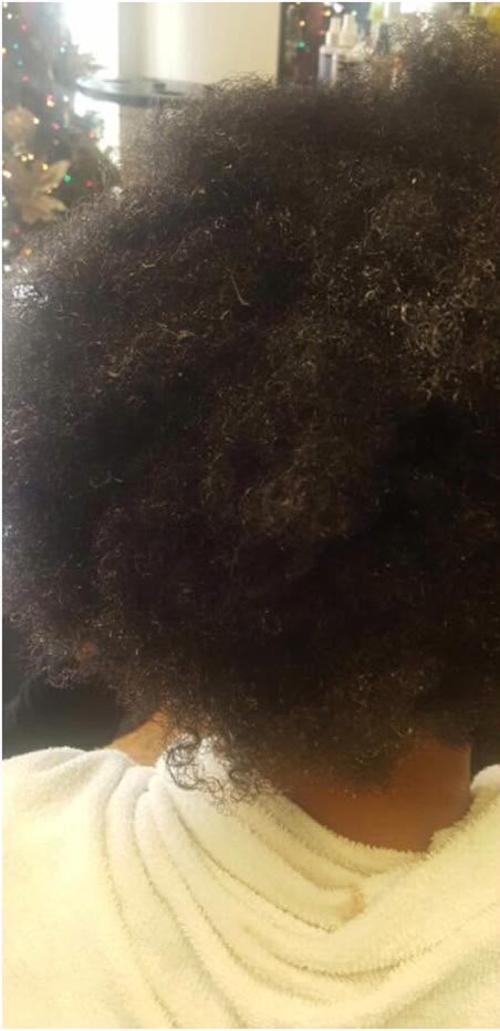 Antes: pelo natural